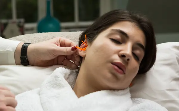 Auricular Acupuncture